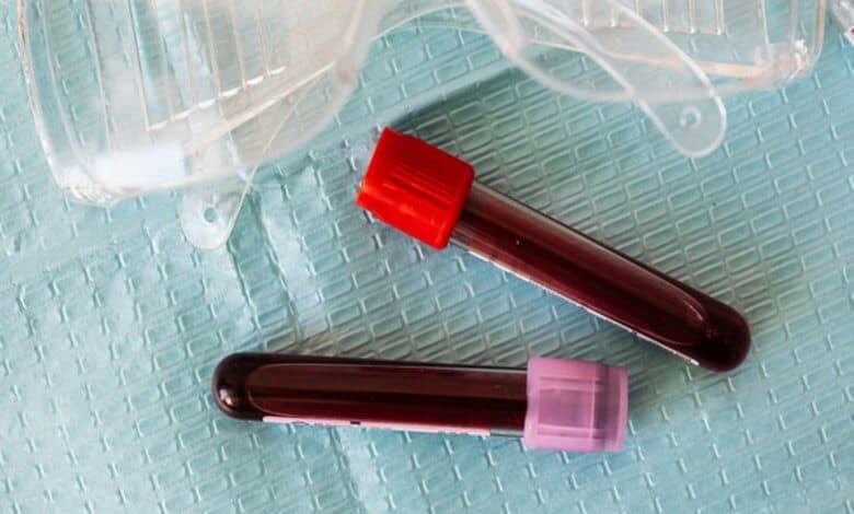 Andhra woman dies after wrong blood group transfused in the body
