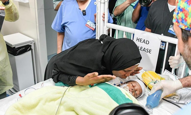 Saudi: Tanzanian conjoined twins successfully separated in 16-hr surgery