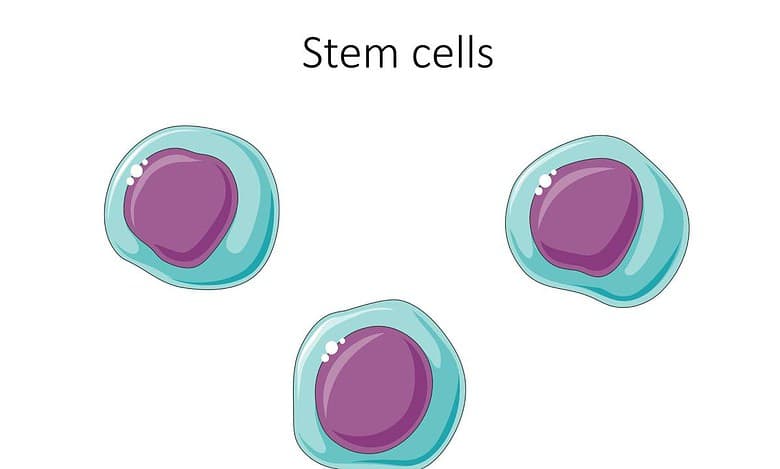 New stem cell therapy may halt multiple sclerosis progression