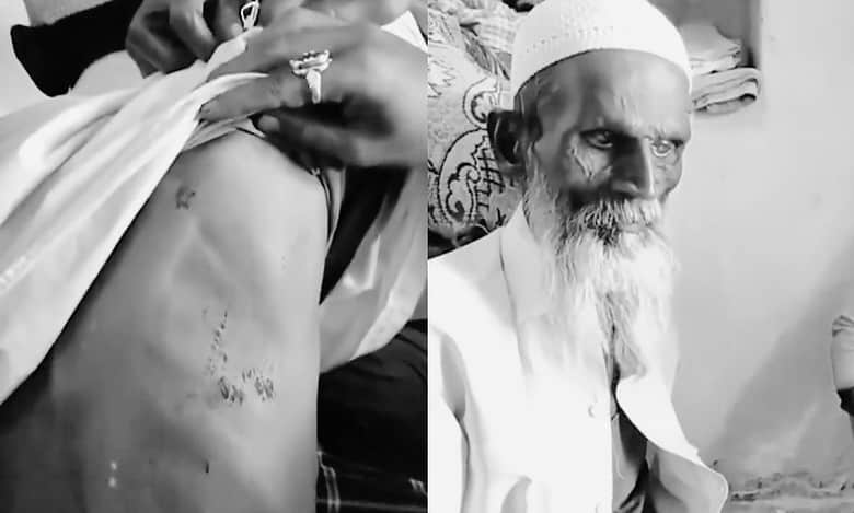 65-year-old man’s beard burnt, forced to chant ‘Jai Shri Ram’ in Karnataka