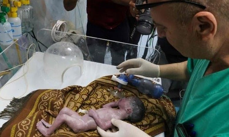Gaza doctors save baby from mother's womb who was killed in Israeli strike