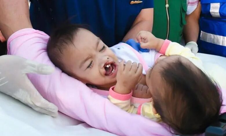Riyadh: Filipino conjoined twins Akhizah and Ayeesha Yusoph arrived in the Kingdom of Saudi Arabia’s capital Riyadh on Sunday, May 5, accompanied by their mother and grandmother for separation surgery. The 16-month-old twins, who share a liver, arrived at King Khalid International Airport via a medical air-evacuation plane. They were taken to the King Abdullah Specialist Hospital (KASH) for Pediatrics at the Ministry of the National Guard for medical examination and potential surgical separation. https://twitter.com/SBAgovSA/status/1787162573088985169?t=TZEZ88cBXuDiHHHlyxji4A&s=19 The initiative came after the directives of the Custodian of the Two Holy Mosques, King Salman bin Abdulaziz Al-Saud, and Prince Mohammed bin Salman bin Abdulaziz Al-Saud, Crown Prince and Prime Minister of Saudi Arabia. Dr. Abdullah Al-Rabeeah, advisor at the Royal Court and General Supervisor of King Salman Humanitarian Aid and Relief Centre (KSRelief), expressed gratitude for the Saudi Conjoined Twins Program's support, the Saudi Press Agency (SPA) reported. Akhizah and Ayeesha's parents expressed gratitude to the Custodian of the Two Holy Mosques and the Crown Prince for their warm welcome and hospitality upon their arrival in the Kingdom. https://twitter.com/alekhbariyatv/status/1787151234719187442?t=ItxhOep9DkFW-0l5G16vXA&s=19 https://twitter.com/alekhbariyatv/status/1787185438324646180?t=ugghpRcj0WOotPkmn2mTgw&s=19