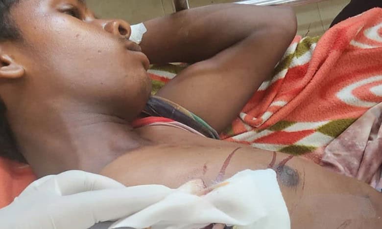 An Adivasi boy from Chhattisgarh with an arrow pierced into his chest was saved on his last legs after a four-hour operation conducted by the surgeons of the cardiothoracic department of NIMS.