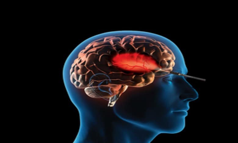 'Aggression, confusion, altered behaviour may signal brain tumour risk'