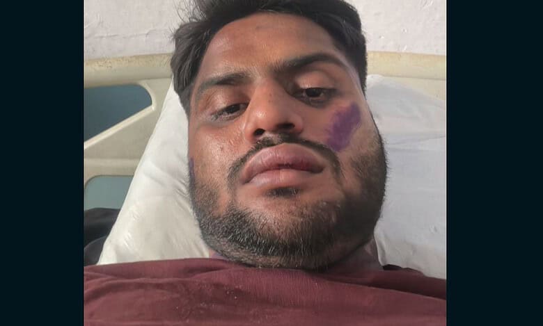 UP: Mob assaults 25-yr-old doctor, Istekhar, after learning his name