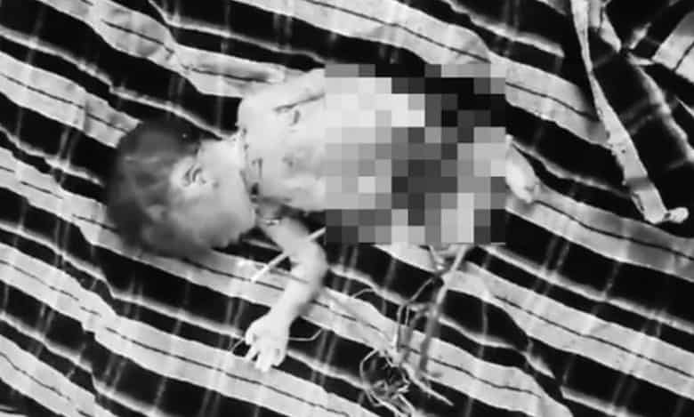 A newborn baby has been found being eaten by street dogs inside the MGM hospital in Warangal on Friday.