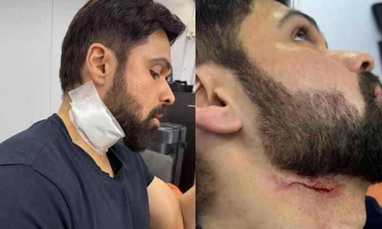 Emraan Hashmi injured on sets of 'Goodachari 2' in Hyderabad