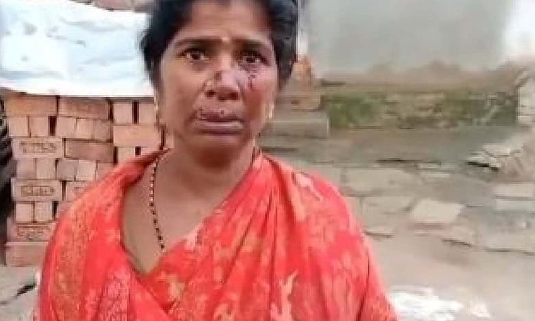 Jackal attacks villagers in Telangana's Sircilla, woman injured