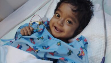 Smiling young child in hospital gown after successful paediatric liver transplant in Dubai, lying in a hospital bed with monitoring wires attached.