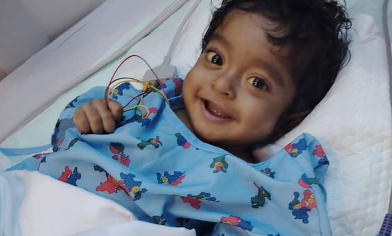 Smiling young child in hospital gown after successful paediatric liver transplant in Dubai, lying in a hospital bed with monitoring wires attached.