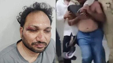 Youtube channel operator D Girish allegedly attacked by Bandi Sanjay's henchmen.