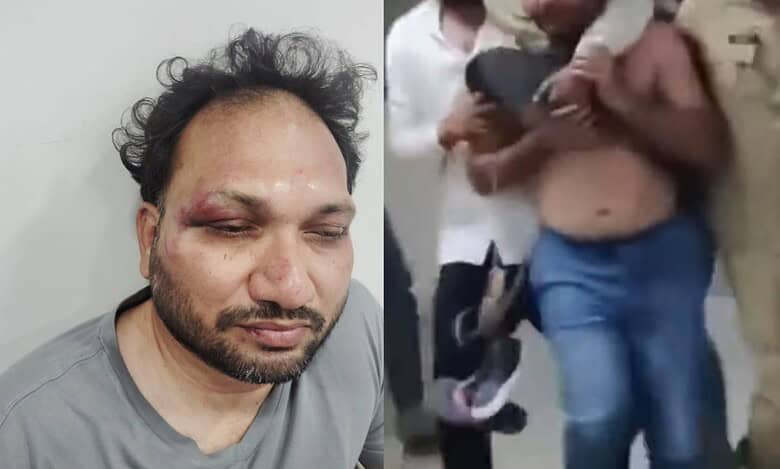 Youtube channel operator D Girish allegedly attacked by Bandi Sanjay's henchmen.