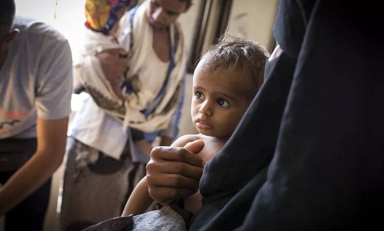A malnourished child receives medical treatment at an Action Against Hunger health clinic in Yemen, highlighting the ongoing humanitarian crisis and child malnutrition in the region.