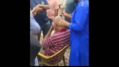 Video: Barber's hair regrowth lotion sends bald men to hospital in Hyderabad