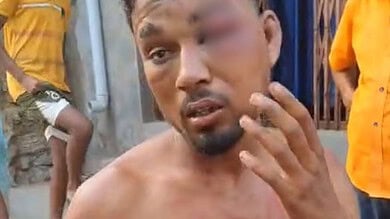 The image shows a young man beaten up in Chhattisgarh . April 13, 2025