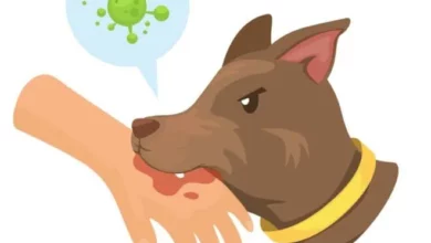 Representational image of a dog biting a person