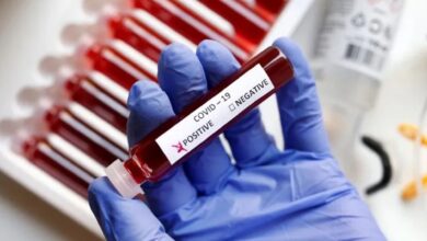 The image displays a picture of blood test and a label on which COVID-19 is written