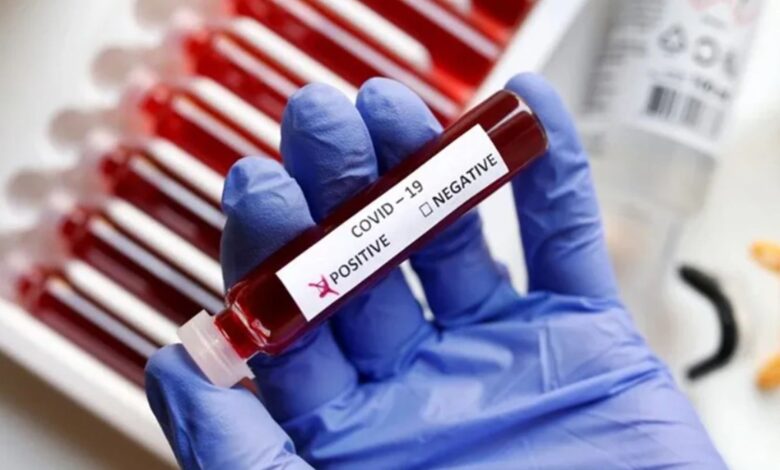 The image displays a picture of blood test and a label on which COVID-19 is written