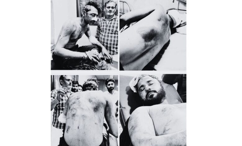 The image displays four grievously injured Muslim men attacked by a Hindutva gang in Aligarh