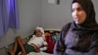 A young burns patient in Gaza lies in bed as his mother applies ointment to his injured body, carefully tending to his wounds.