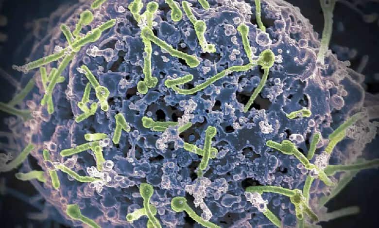 measles