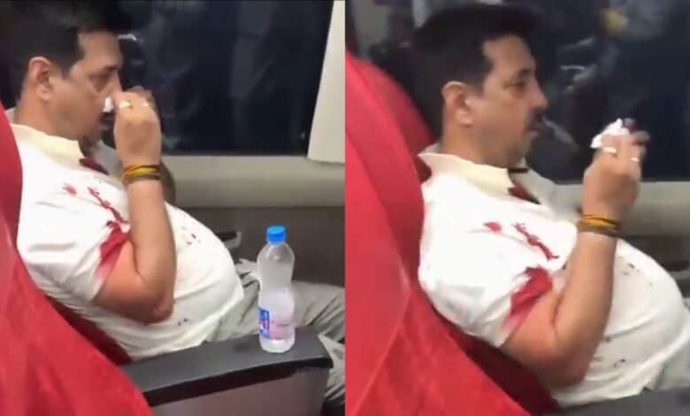 A profusely bleeding Vande Bharat passenger who was assaulted by a BJP MLA in Madhya Pradesh