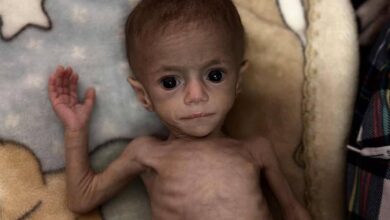 The image of a severely malnourished infant, Siwar Ashour, lies on a patterned blanket, her ribs visibly protruding. Her eyes appear large and sunken, reflecting the impact of prolonged hunger. An adult hand gently supports her arm.