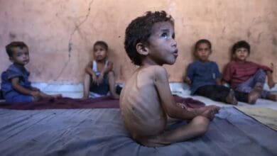 A severely malnourished Palestinian boy sits with his siblings inside their damaged home in Gaza’s Shati refugee camp.