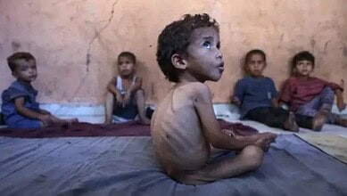 Malnourished children in Gaza