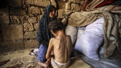 Woman consoles her malnourished six-year-old daughter at a shelter in central Gaza City