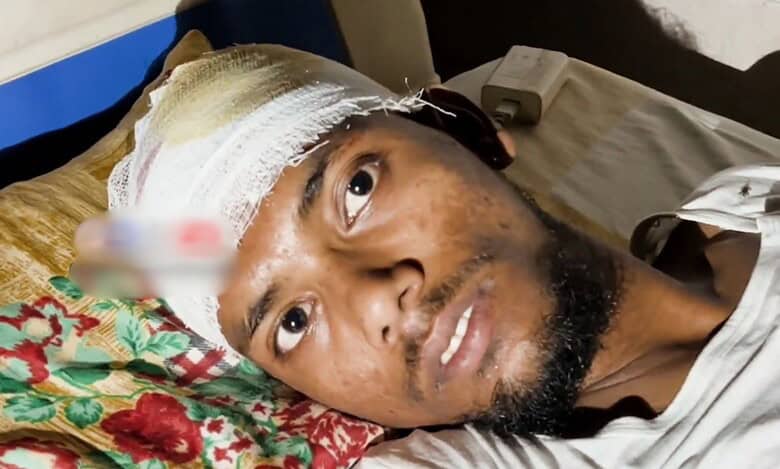 A grievously injured Mohammed Ibrahim