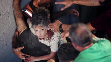 Injured Palestinian child covered in dust and blood is carried by rescuers after an Israeli airstrike hit buildings in the Al-Rimal neighbourhood of Gaza City, August 30.