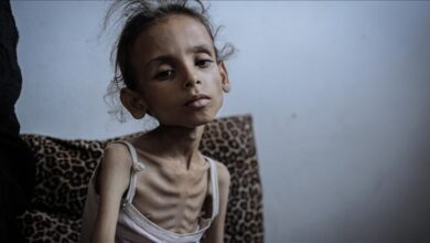 Severely malnourished child sits on a patterned cushion, showing visible signs of starvation.