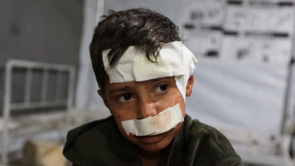 A wounded Palestinian child with bandages on his face and head receives medical treatment after an Israeli airstrike in Gaza.