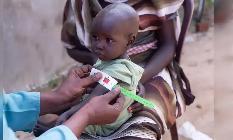 A health worker measures the arm of a malnourished child in Sudan.