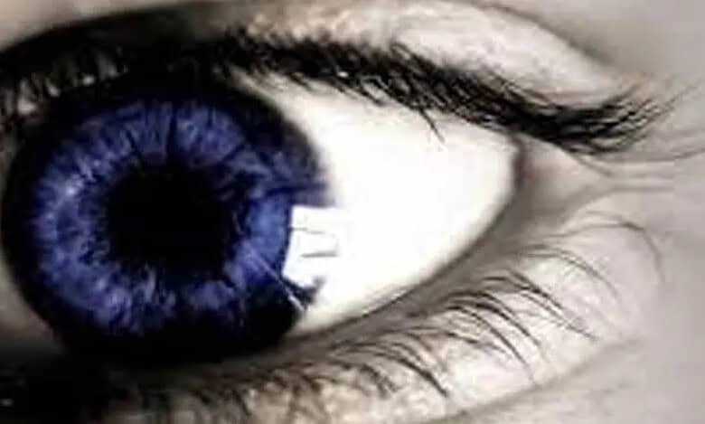 Eye