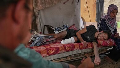 Yassin Marouf, 23, who lost his left foot and suffered a severe injury to his right leg after being hit by Israeli shelling in May, lies in a tent surrounded by his family in Zawaida, central Gaza (Abdel Kareem Hana/AP)