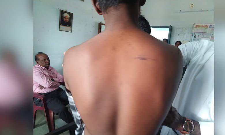 Image shows a wound on a student's back