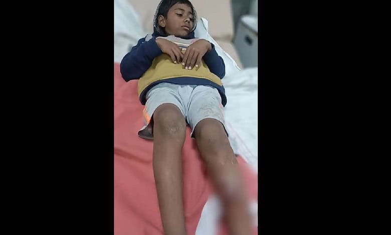 8-year-old boy attacked by stray dogs in Hyderabad