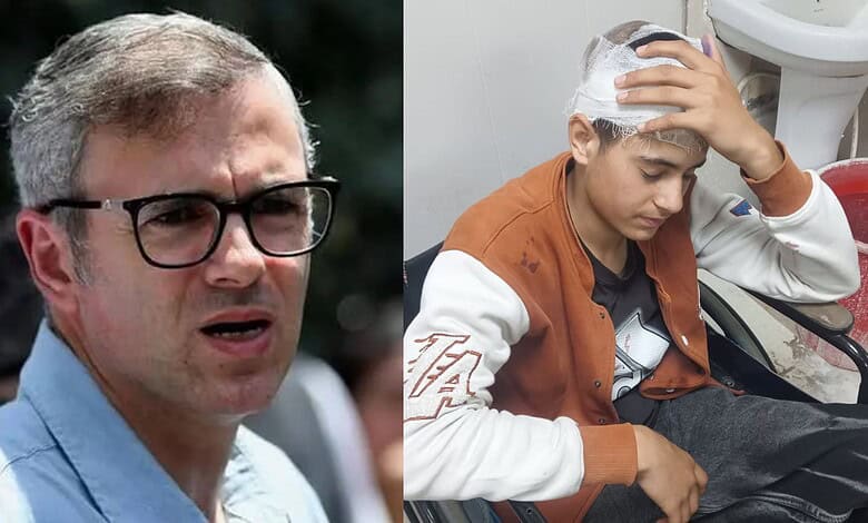 Kashmiri teenager attack: Main accused held after CM Omar’s intervention