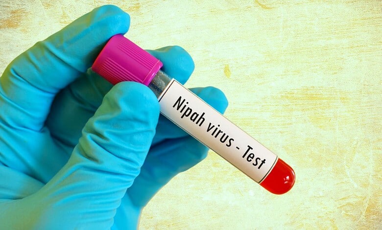 nipah virus