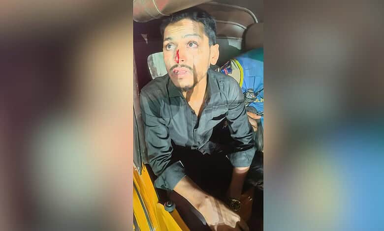 Injured man with blood on face after assault in Hyderabad's Troop Bazaar area. Tension reported following.