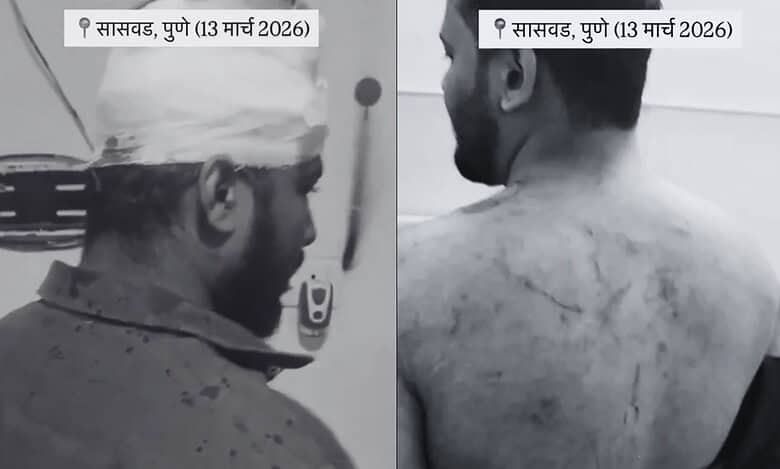 Man attacked during Iftar at Pune tourist location, causing injuries; police register 150 cases.