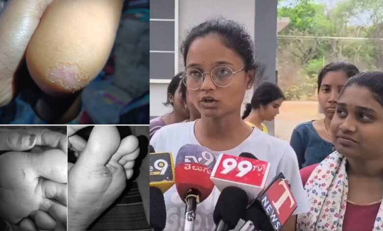 Kakatiya University students complain of rat bites, neglect in hostel