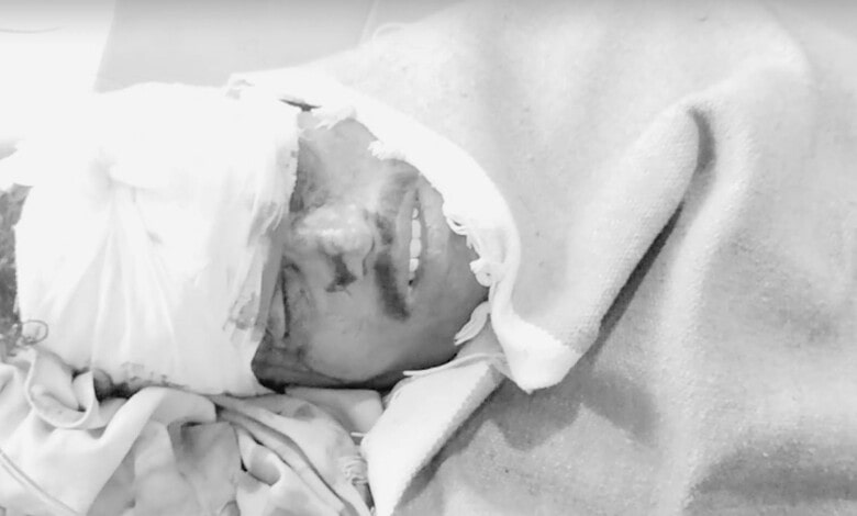 Injured individual with head bandage lying on hospital bed, receiving medical treatment.