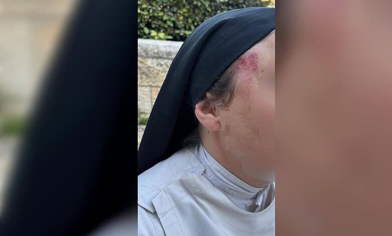 Nurse with facial injuries and bruising, wearing a black head covering, outdoors in natural light.