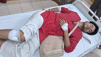 The image shows an ABVP activists injured in the violence between student groups which happened on HCU campus on Monday night, May 4, 2026.