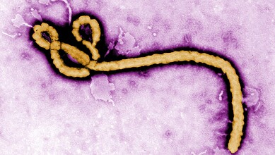 Illustration of a virus particle with a purple background, representing microbiology or infectious diseas.